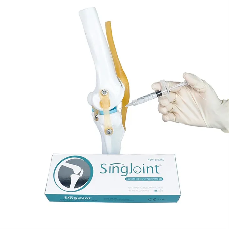 Singjoint Hyaluronic Acid ViscoSupplemental инжектиране на коляното